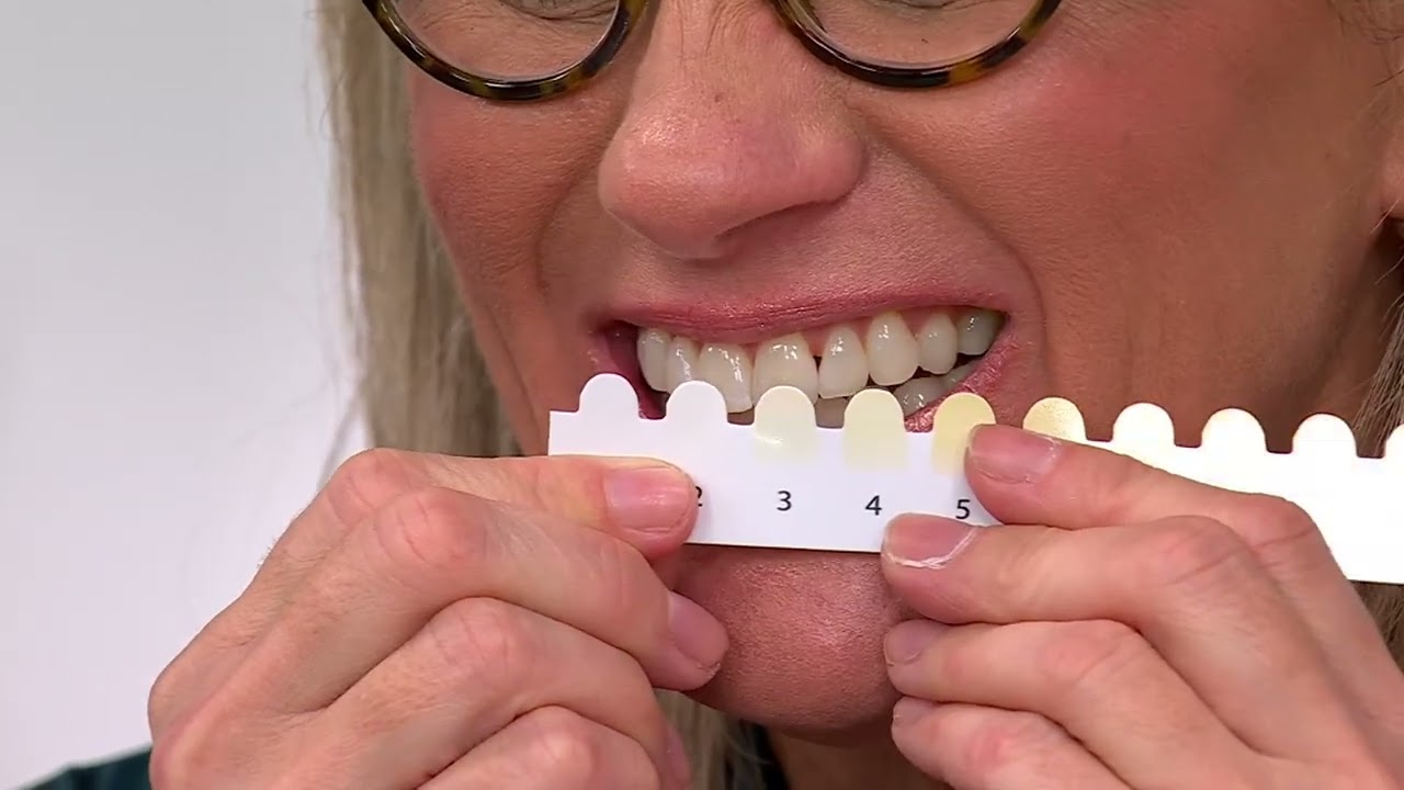 Supersmile Teeth Whitening Home & Away 6-pc System Auto-Delivery on QVC