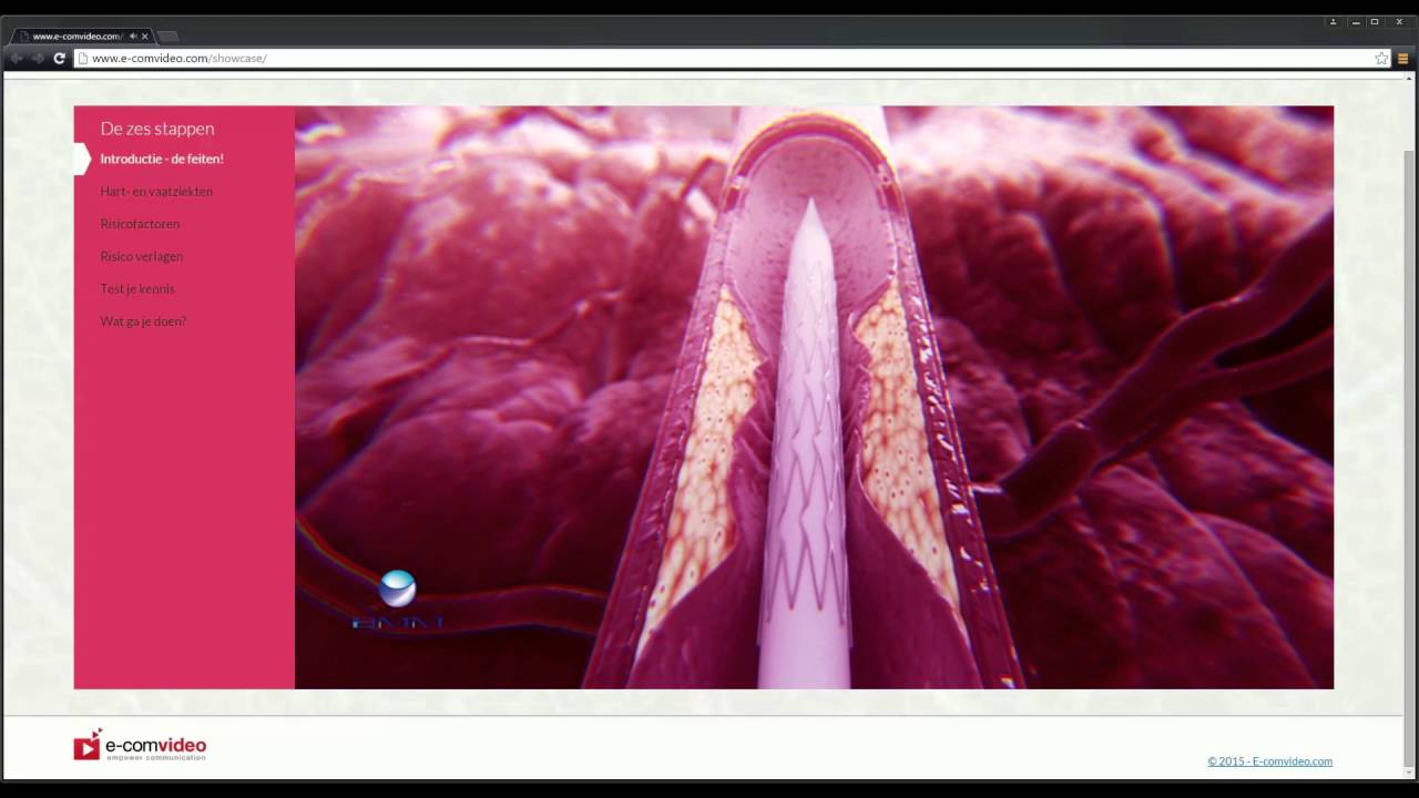 ZORG VIDEO HULP - een interactieve Patienteninformatie video-oplossing