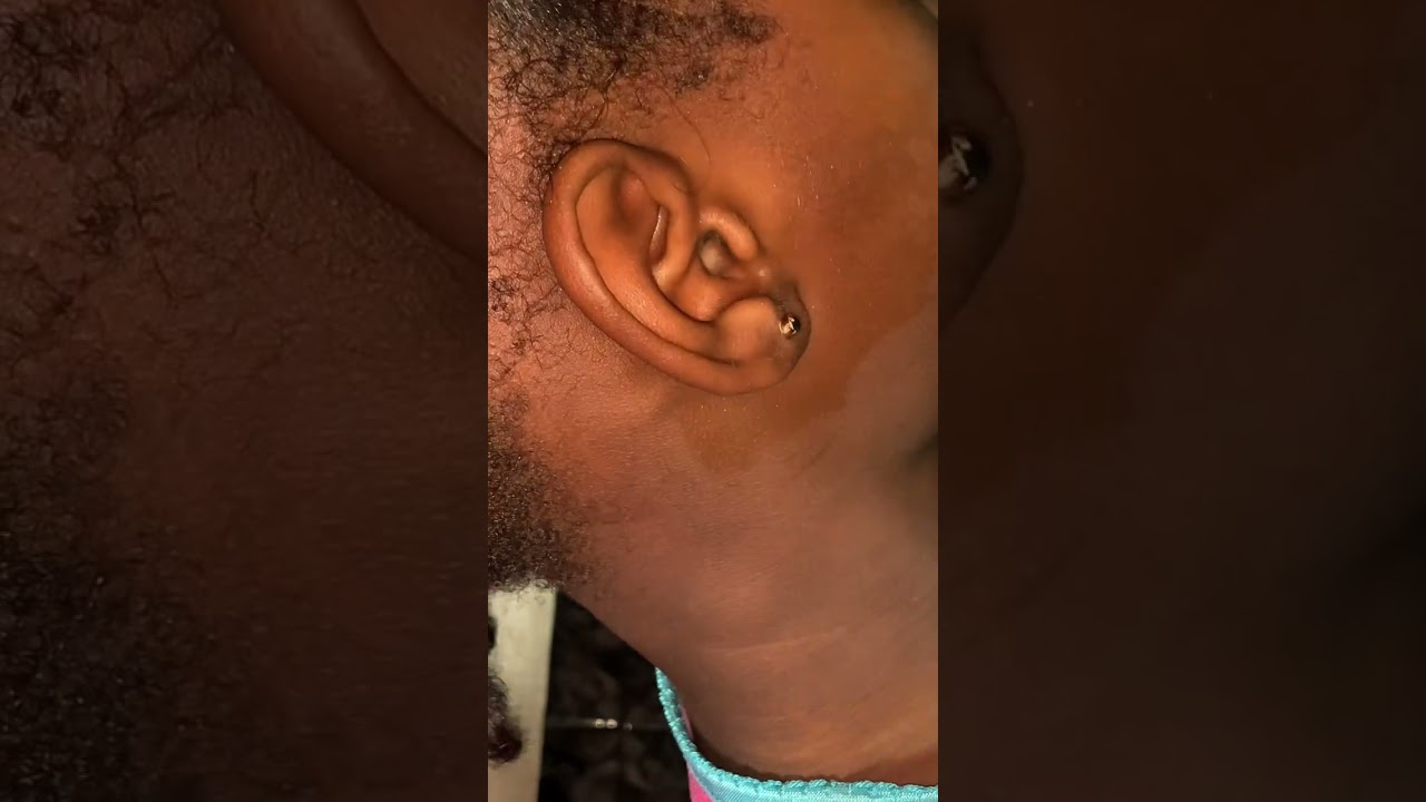 #asmr #EarCleaning #GumSounds #MicTingles #TingleASMR #ASMRWhisper #asmrsounds ASMRAddict #ViralASMR