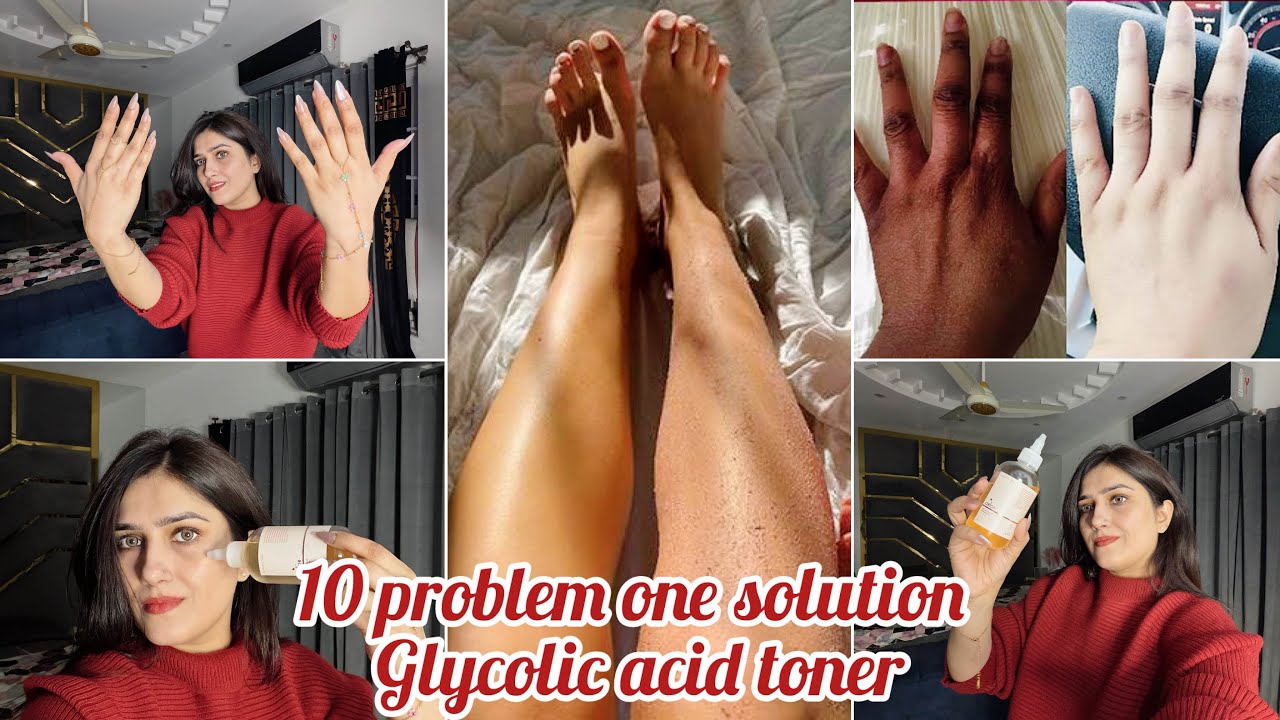 10 Problem 1 Solution Glycolic Acid Toner | No more dark body parts 
