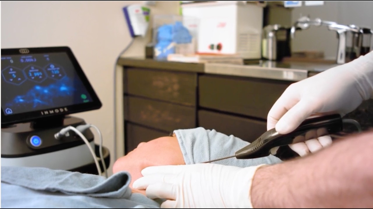 QuantumRF: A Plastic Surgeon’s Perspective