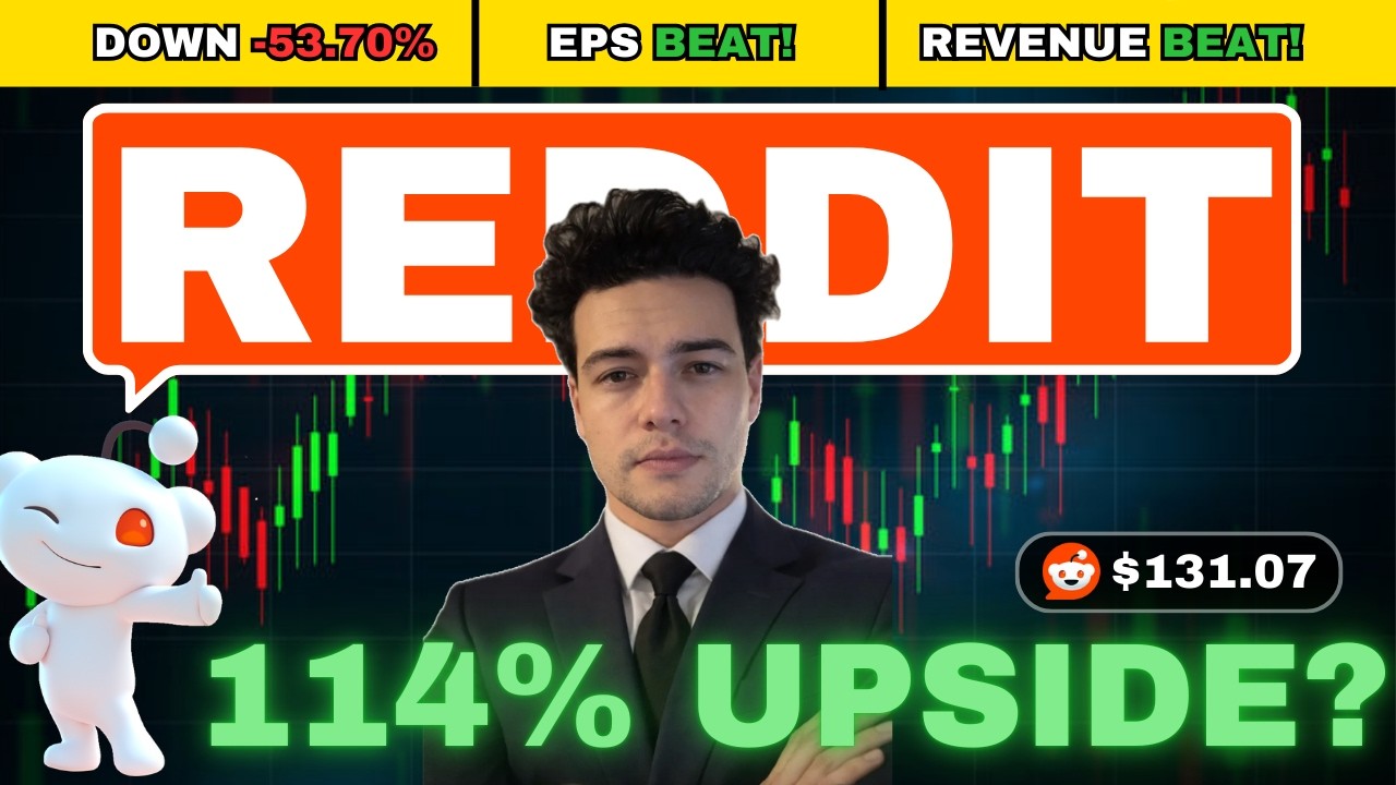 Why I&rsquo;m Buying the Reddit 