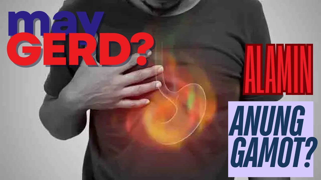 Mga Uri ng Gamot sa GERD  Alamin Kung Kailan Dapat Inumin!