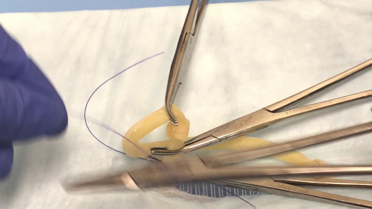 Clamping and ligating ovarian pedicle