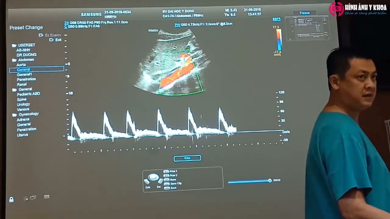 63. Hướng dẫn thực hành siêu âm Doppler động mạch thận, mạch máu chi dưới – BS Dương (SATQ ĐHYD)
