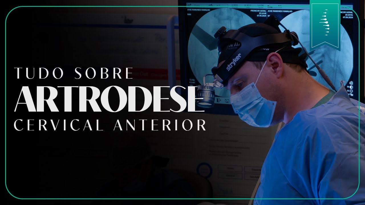 Artrodese cervical anterior: Benefícios, riscos e para quem é indicada!