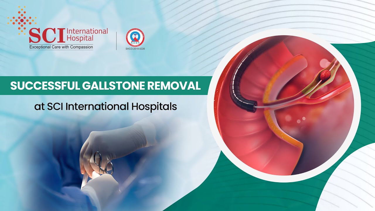 From Pain to Relief: Gallstone Removal Success at SCI International Hospitals