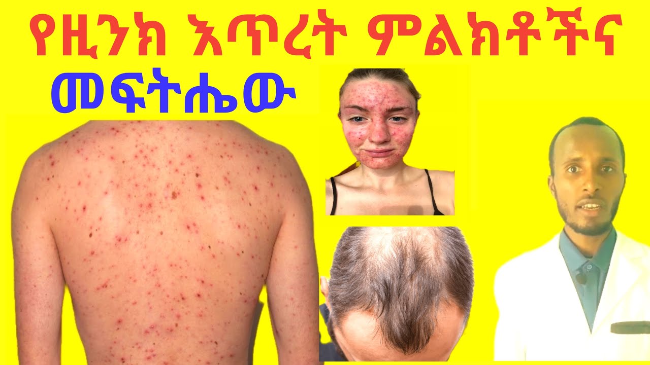 ዚንክ እጥረት ካለብህ ይህን ታያለህ! | Zinc Deficiency Symptoms