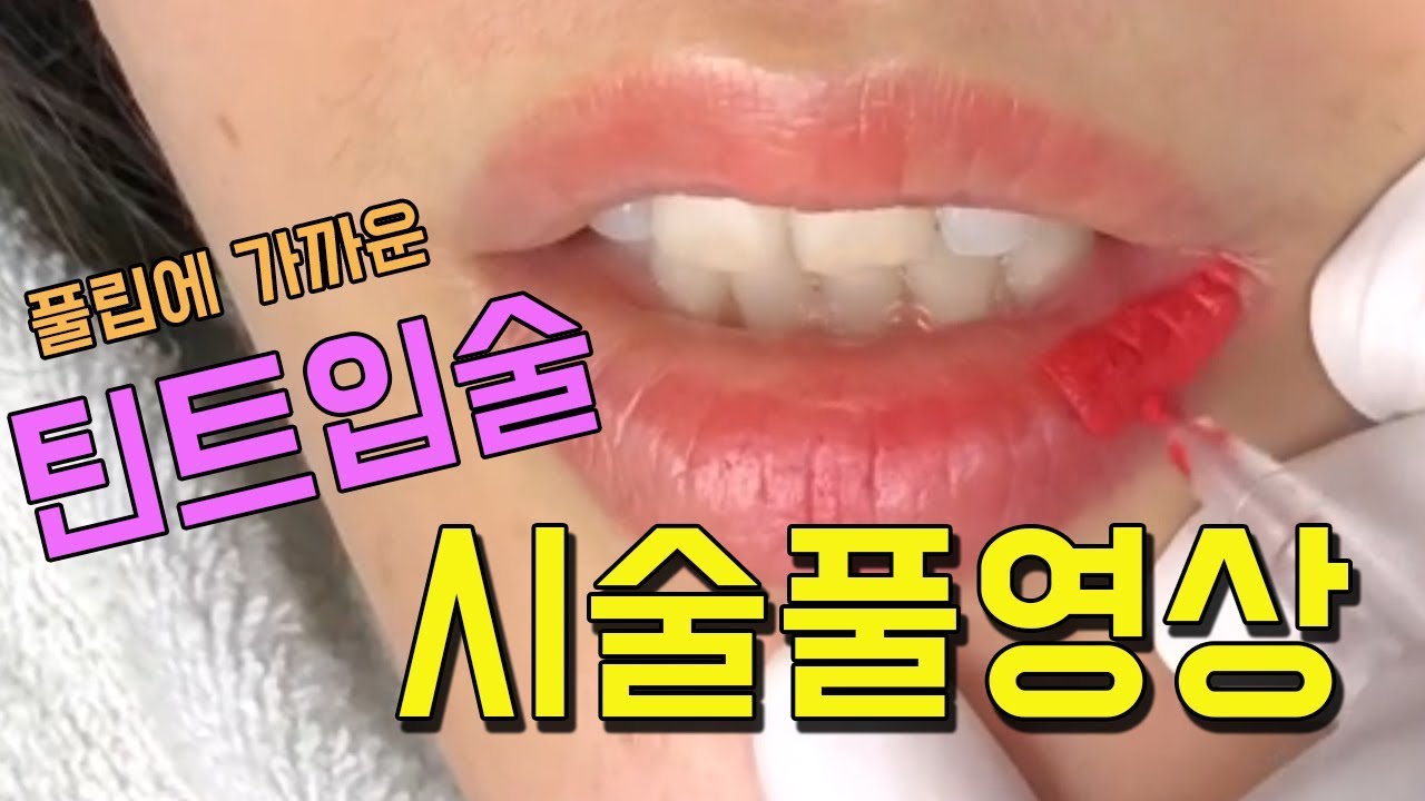 풀립에 가까운 틴트입술 시술풀영상