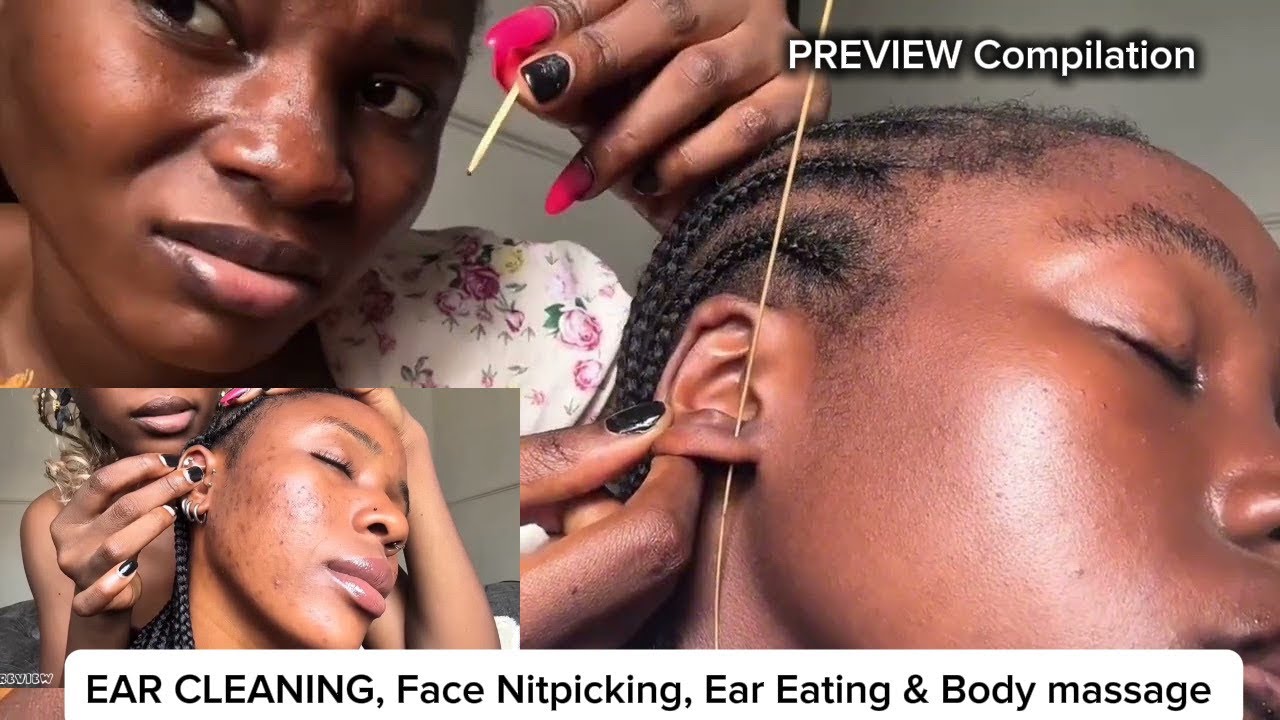 Asmr Ear Cleaning, Ear Eating & Spit Painting + Japanese Head Spa, Beard Grooming & Pimple Popping