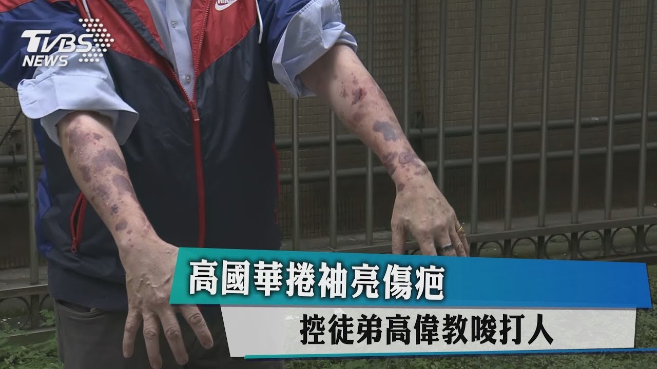 高國華捲袖亮傷疤　控徒弟高偉教唆打人