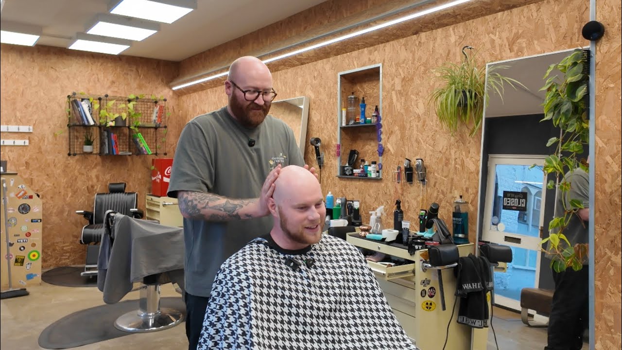 Losing His Hair at 20 Changed Everything — Now It Doesn’t Hold Him Back