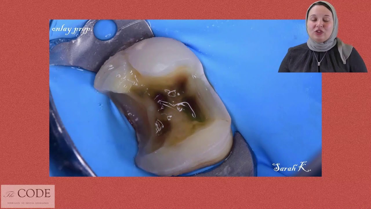Deep Caries Management Dr Sarah Ghattas
