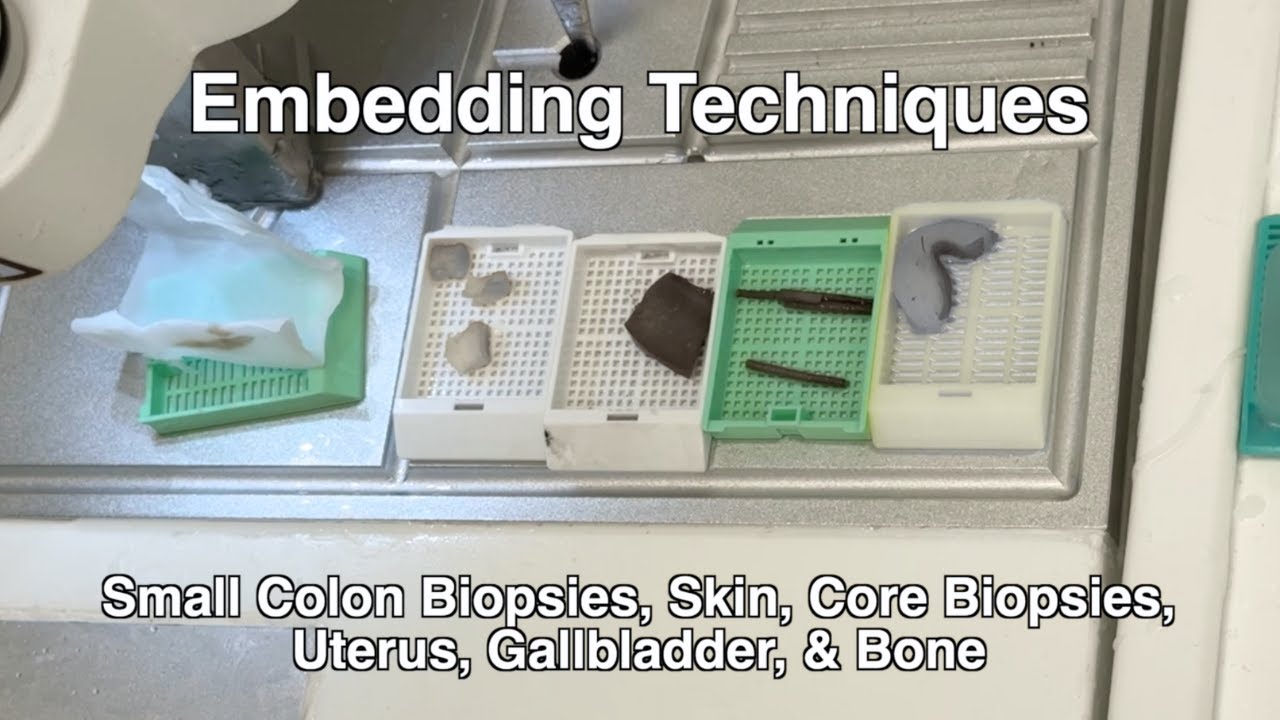 Embedding Techniques for Histotechs: How to Properly Embed Tissue
