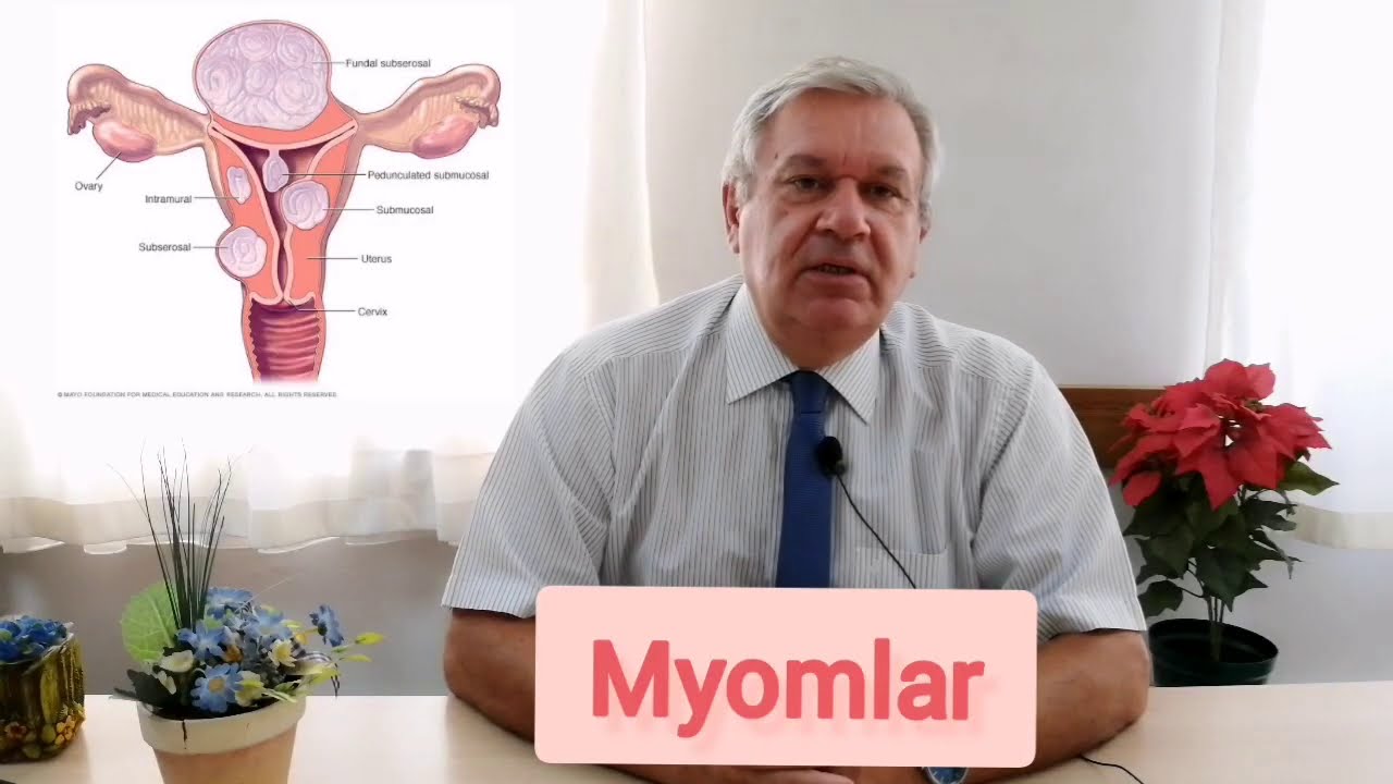 myoma uteri