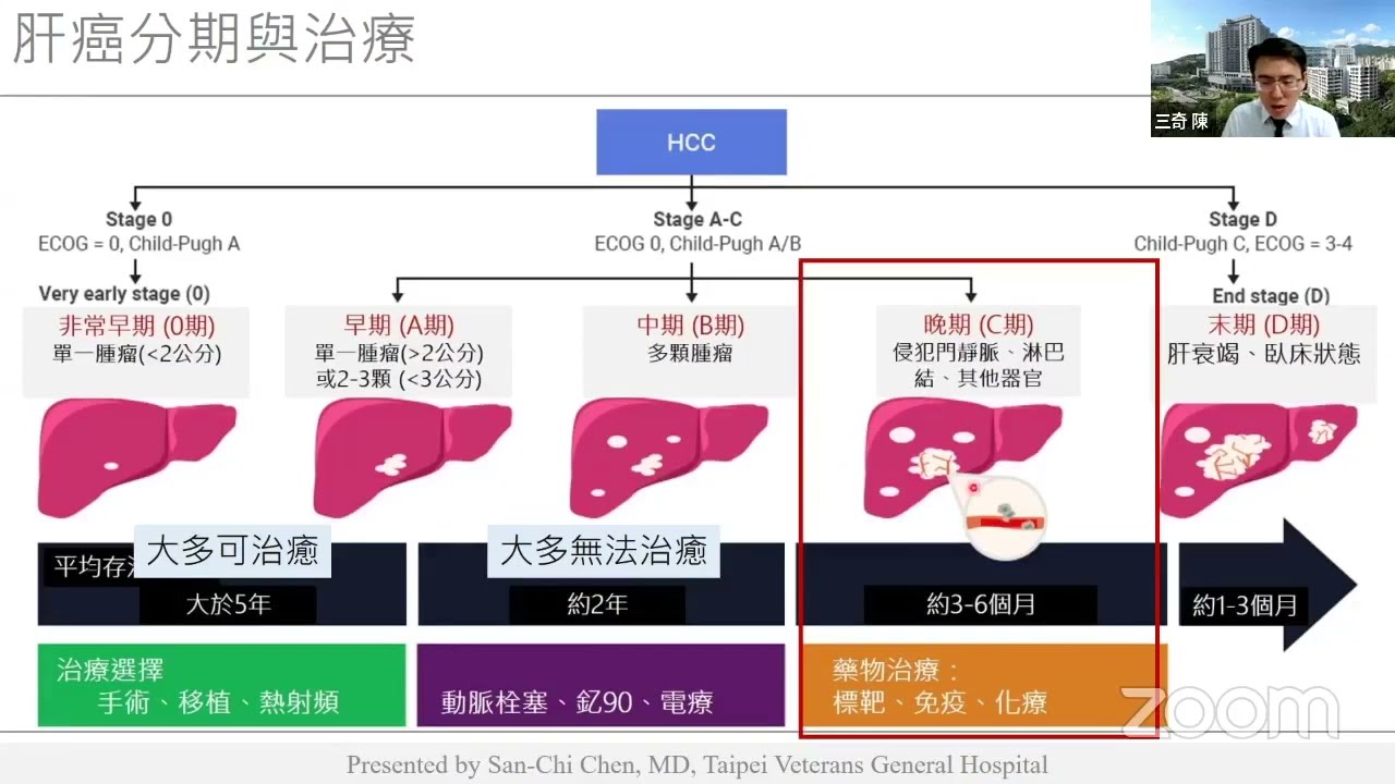 晚期肝癌免疫標靶治療 (Immunotherapy and targeted Therapy for Advanced HCC) - 陳三奇醫師 Dr. San-Chi Chen