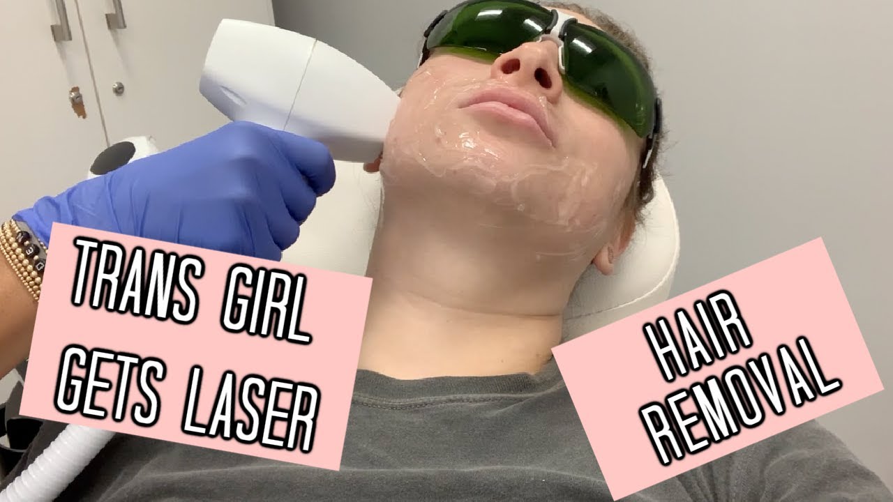Trans girl gets Laser Hair removal