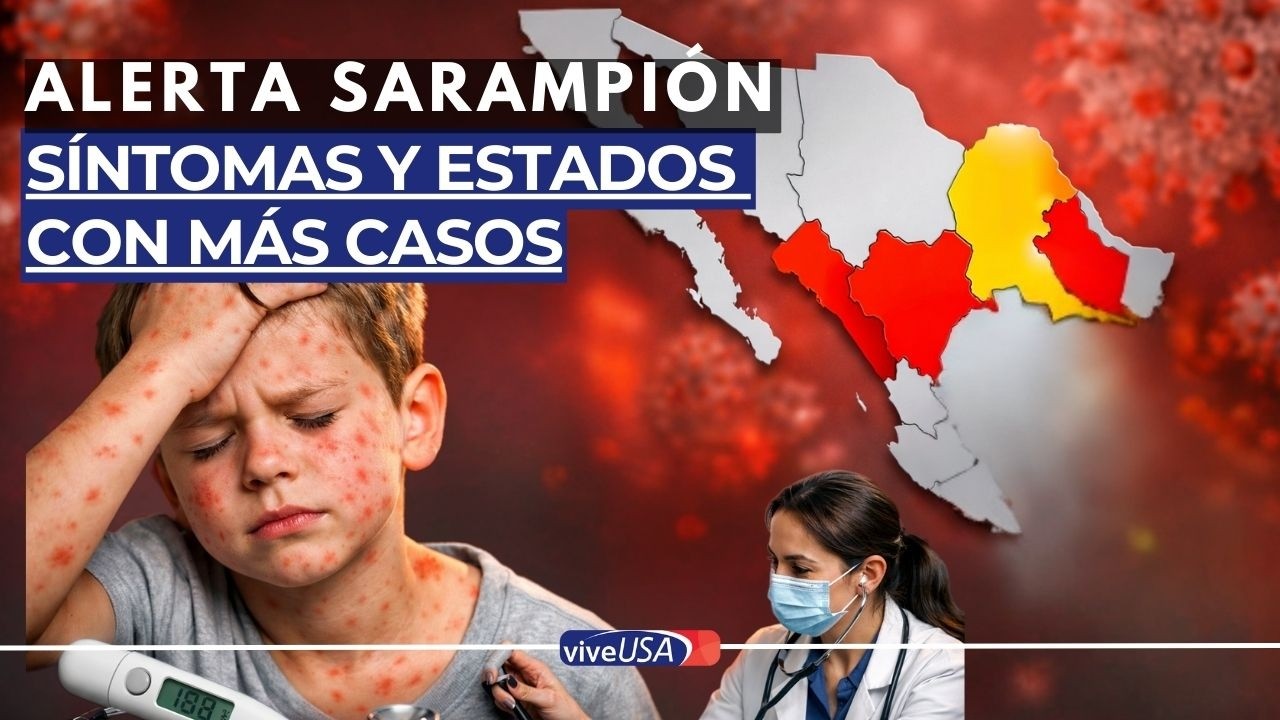 ALERTA por Sarampión en México: Los 5 estados con más casos (y cómo protegerte)