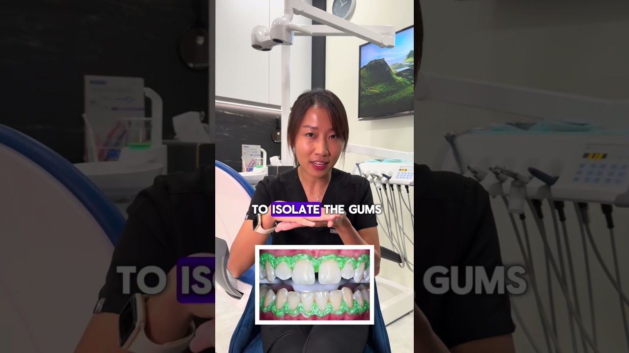 How safe is whitening? #whitening #dental #singapore #dentist