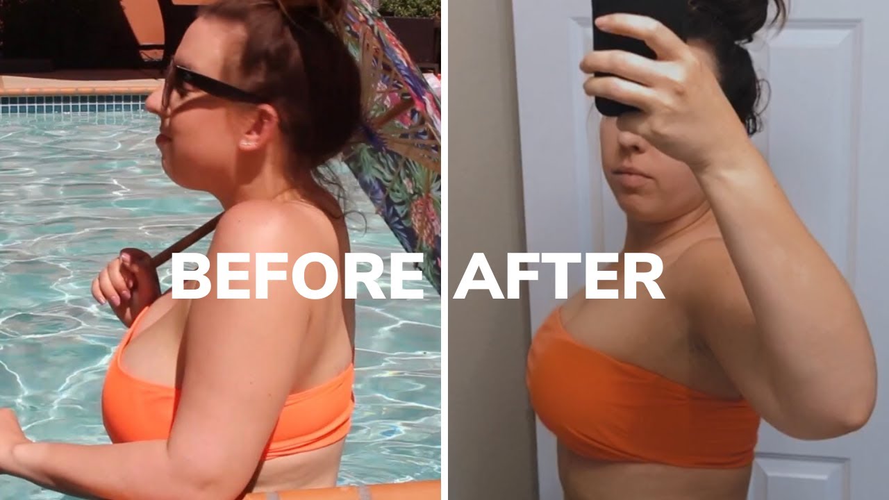 BREAST REDUCTION SURGERY 2 MONTH UPDATE: DRIVING, WORKOUTS, SWELLING, RECOVERY JOURNEY
