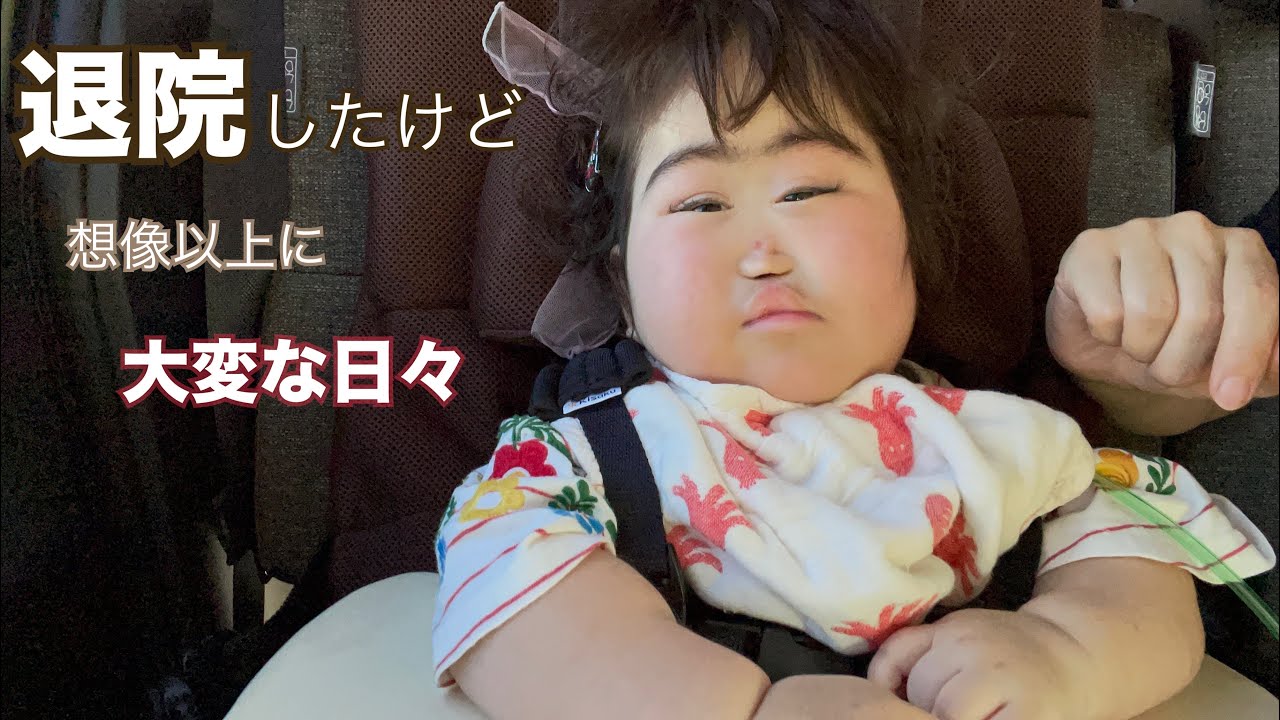 【退院】気管切開/大変な毎日/笑顔は健在