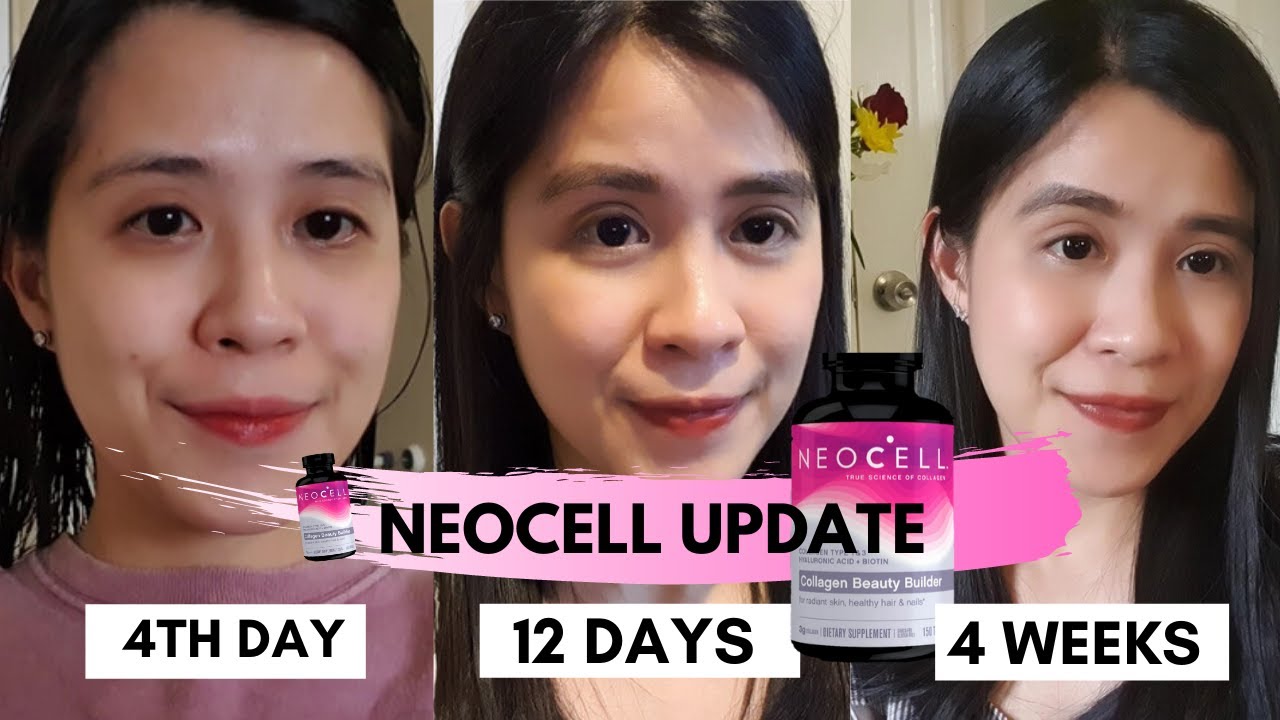 NEOCELL COLLAGEN 1 month UPDATE + NAGULAT AKO SA NANGYARI! |Annee Fair