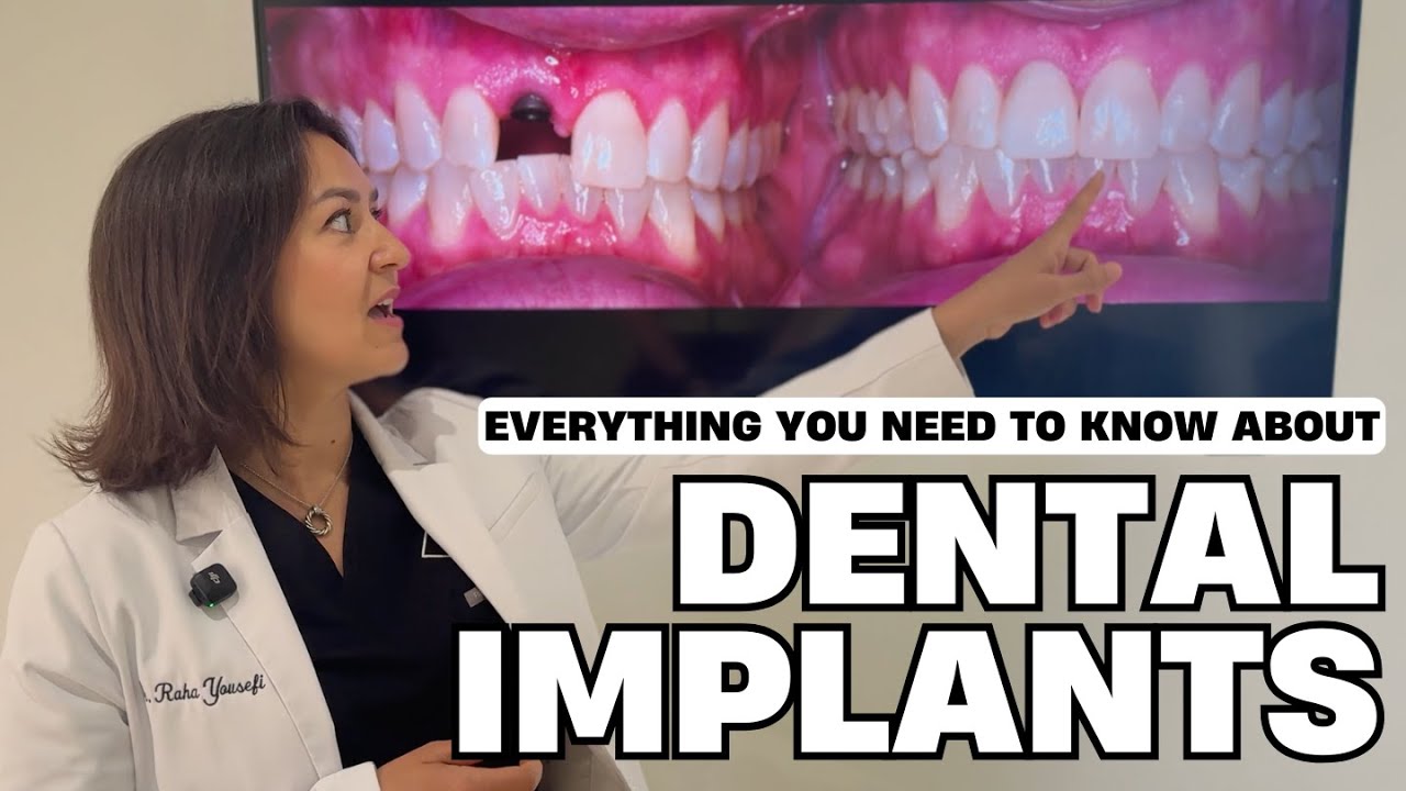 Dental Implants: Everything You Need to Know |  Dr. Raha Yousefi at District Dental Surgery