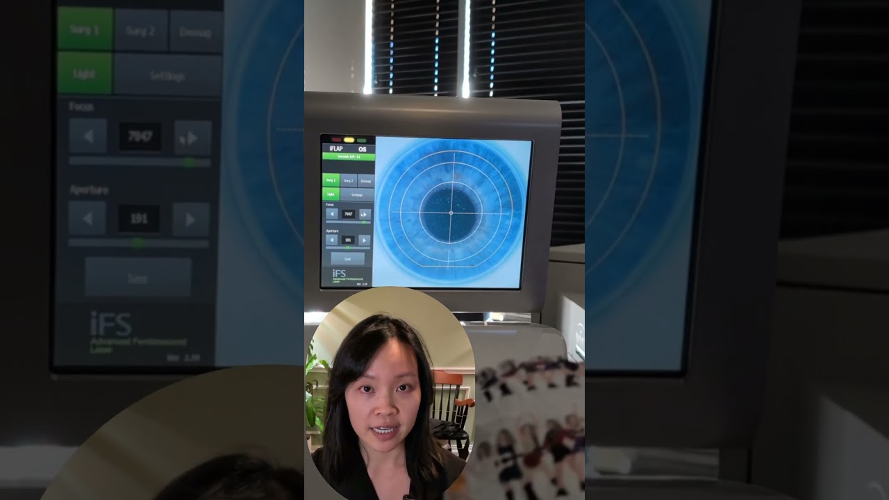 Bladeless LASIK Flap Creation #bladeless #lasik #lasereyesurgery