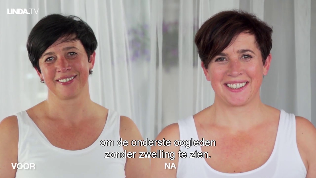 Spiegeltje, Spiegeltje - Ooglidcorrectie