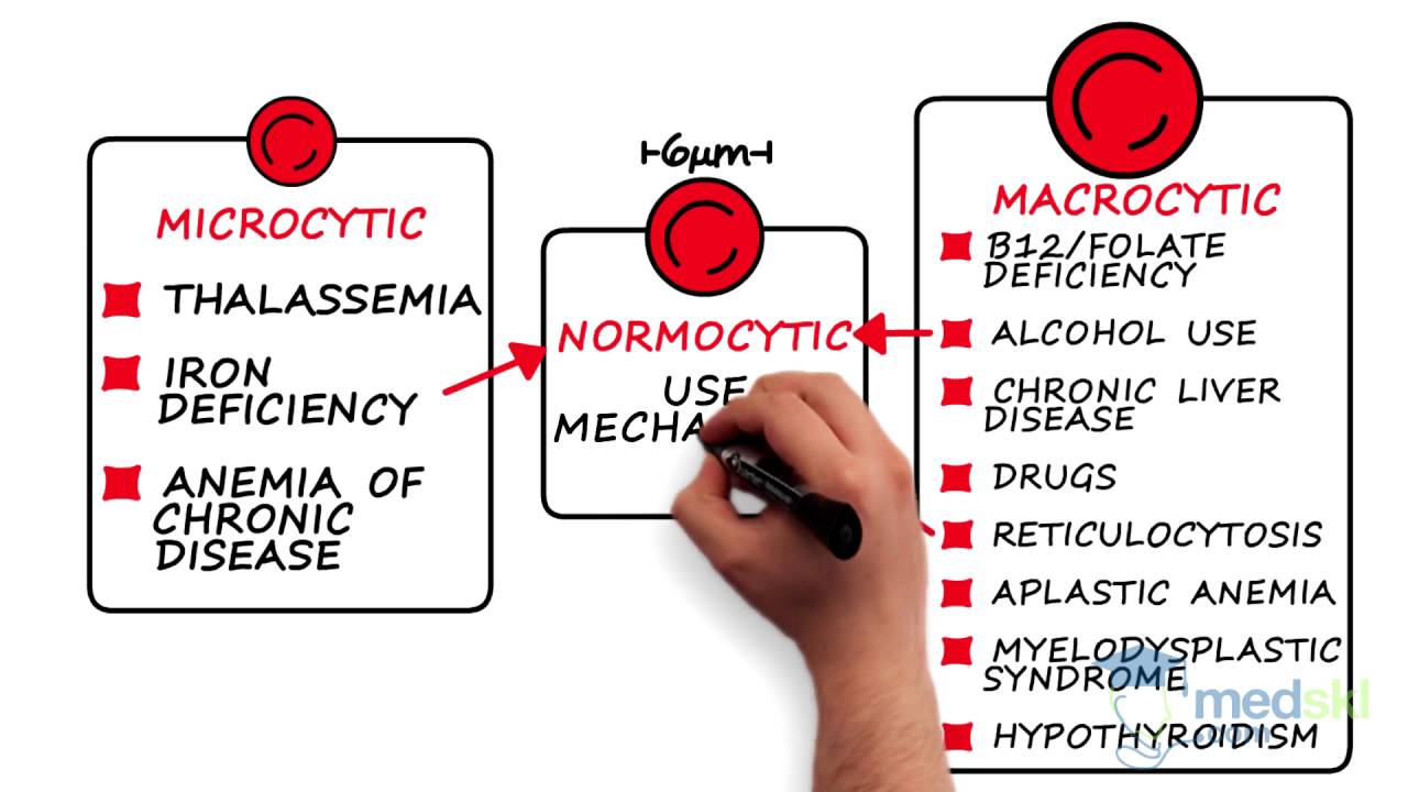 Hematology &ndash; Anemia: By Karima Khamisa M.D.
