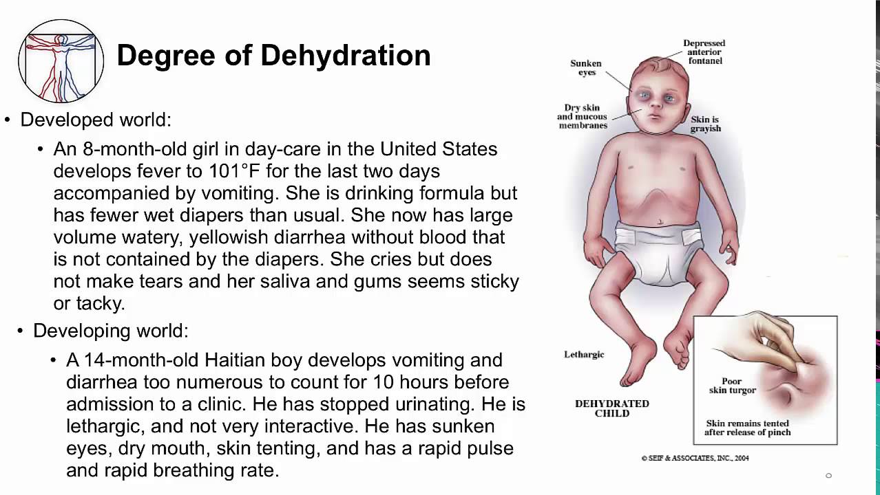 Acute GI: Watery diarrhea and dehydration