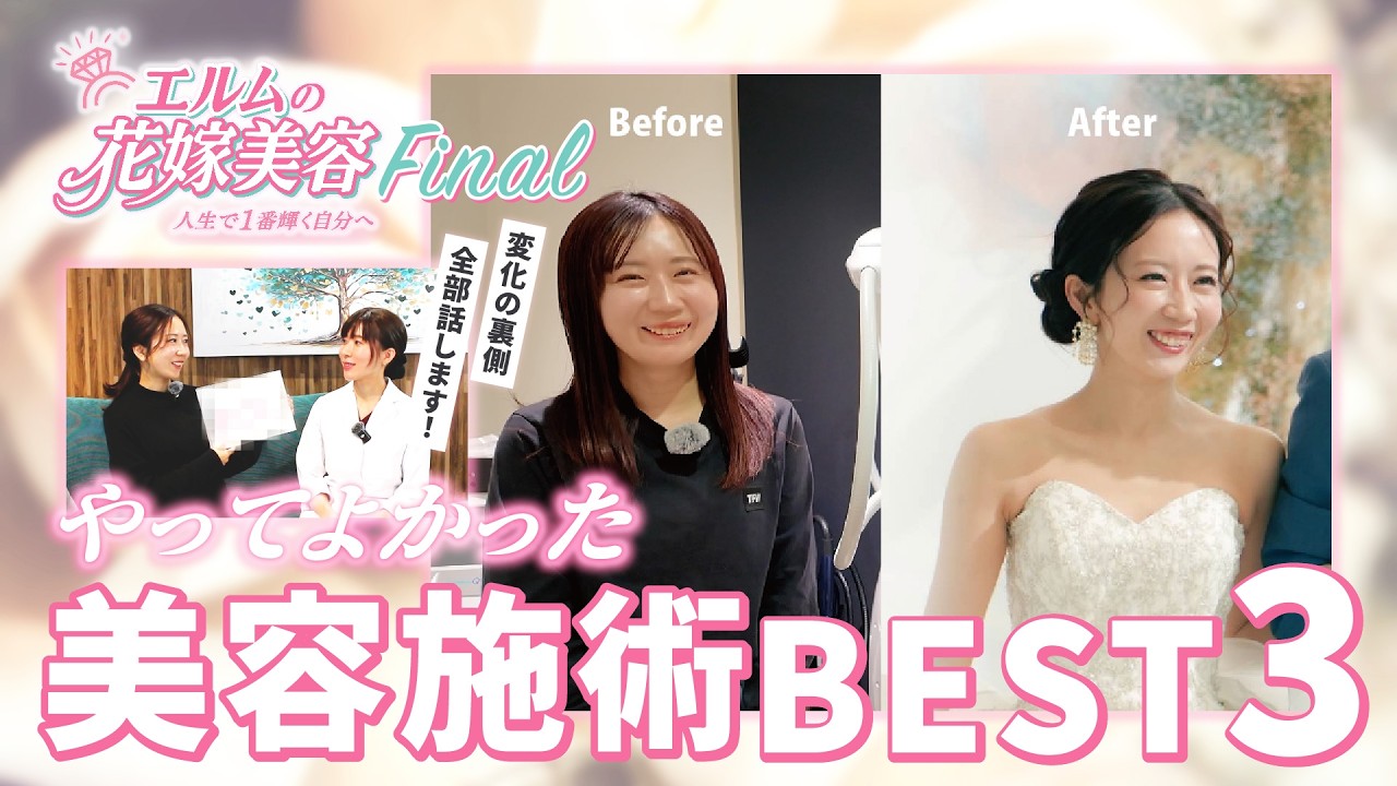 【花嫁美容Final】やってよかった美容施術BEST3
