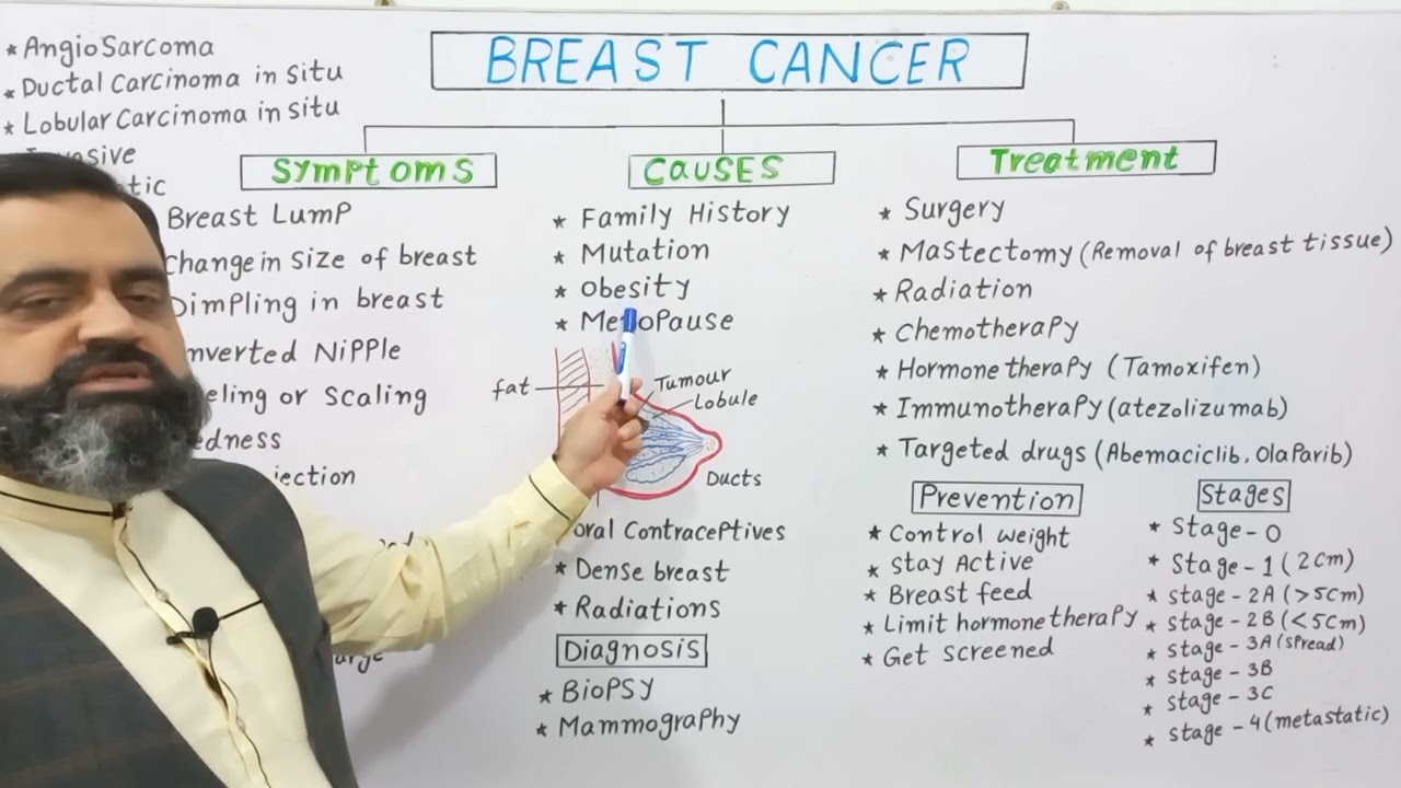 Breast Cancer Urdu/Hindi medium @prof.masoodfuzail| Treatment of Breast Cancer | Lobular Carcinoma