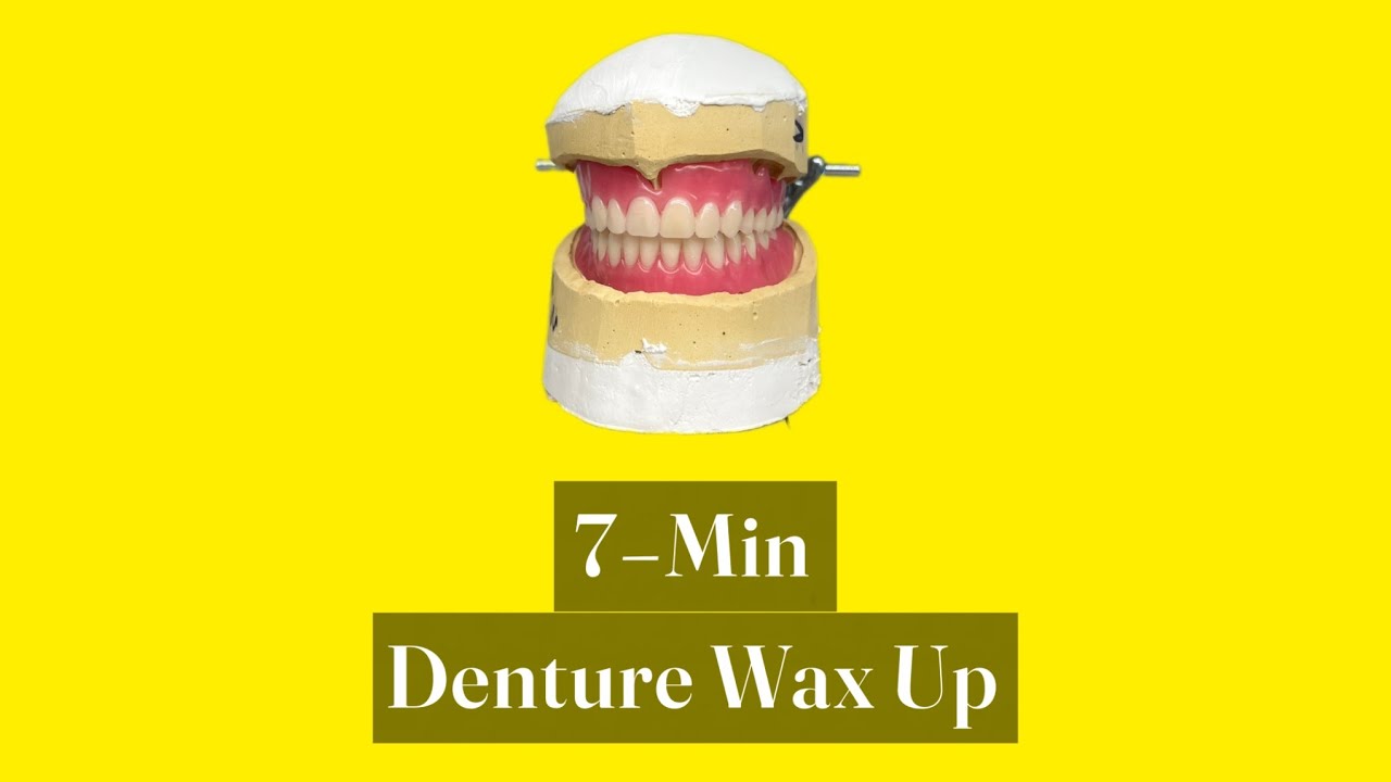 Learn Full Denture Wax-Up in 7 Minutes