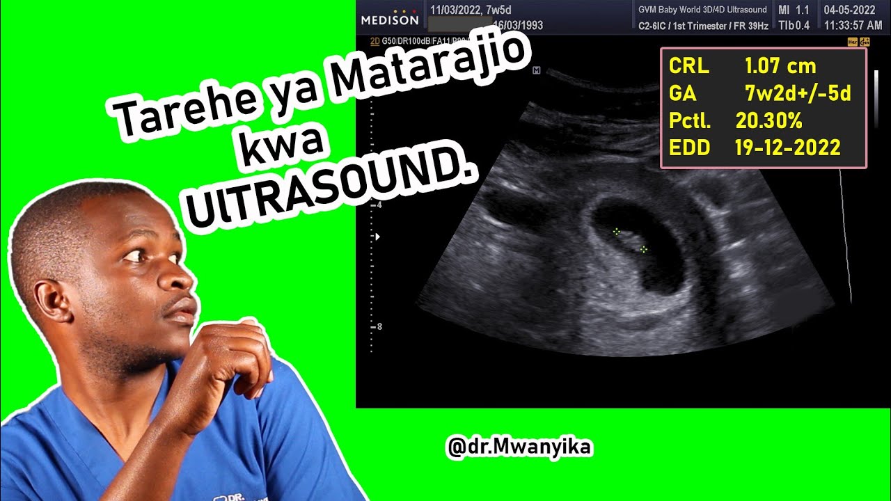 Je Lini Tarehe YA Matarajio ya Ujauzito kwa Ultrasound ni sahihi zaidi? (Je Ultrasound huwa sahihi?)