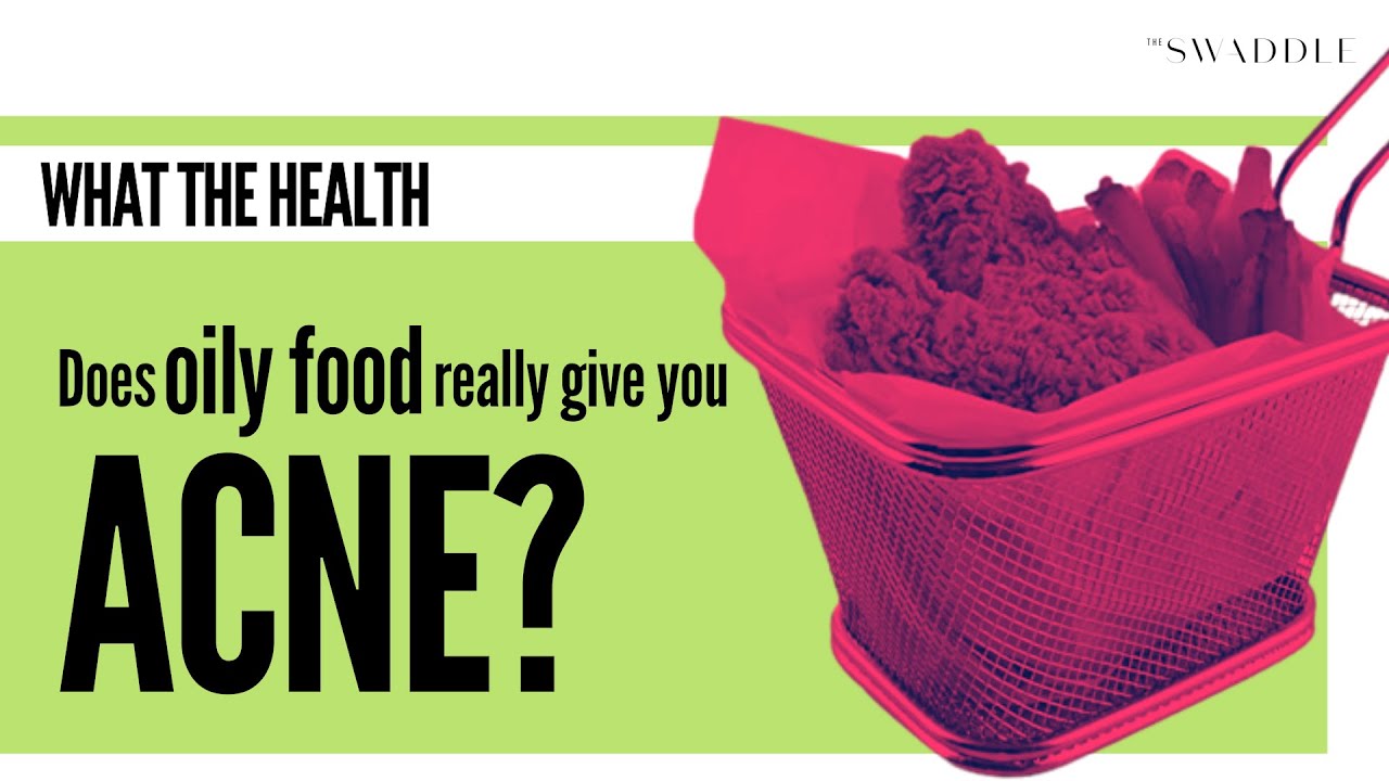 Does Oily Food Really Give You Acne?