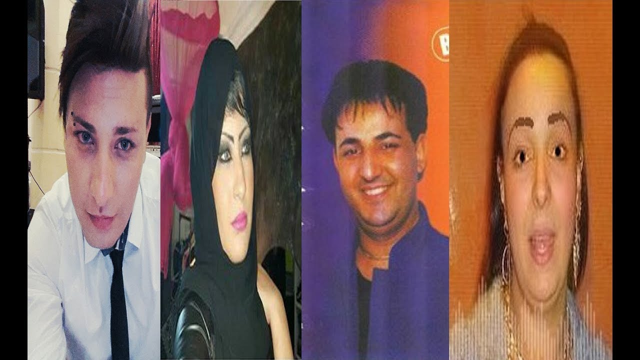 فنانو الراي الجزائري قبل وبعد التحلاب كااااااااااااااااارثة