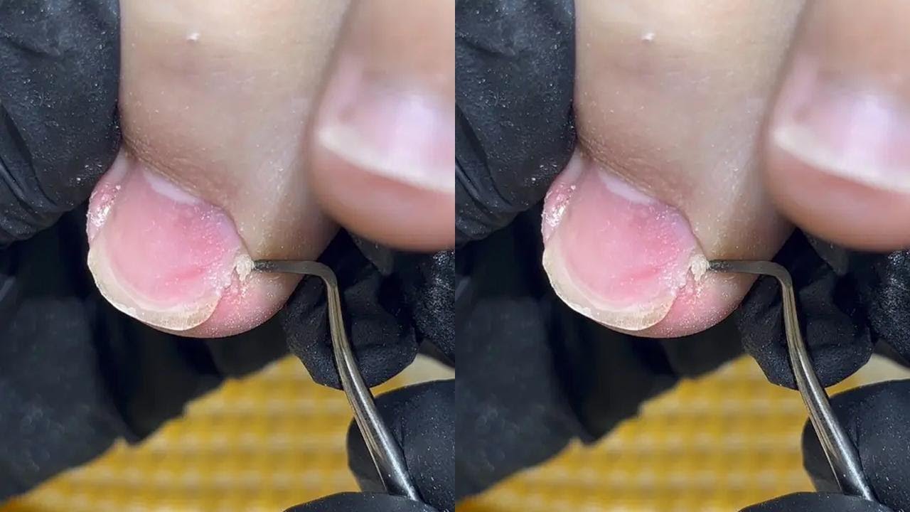 #修脚技术与基本手法 #修指甲 #解压修脚入口 #修脚解压 #成都美甲