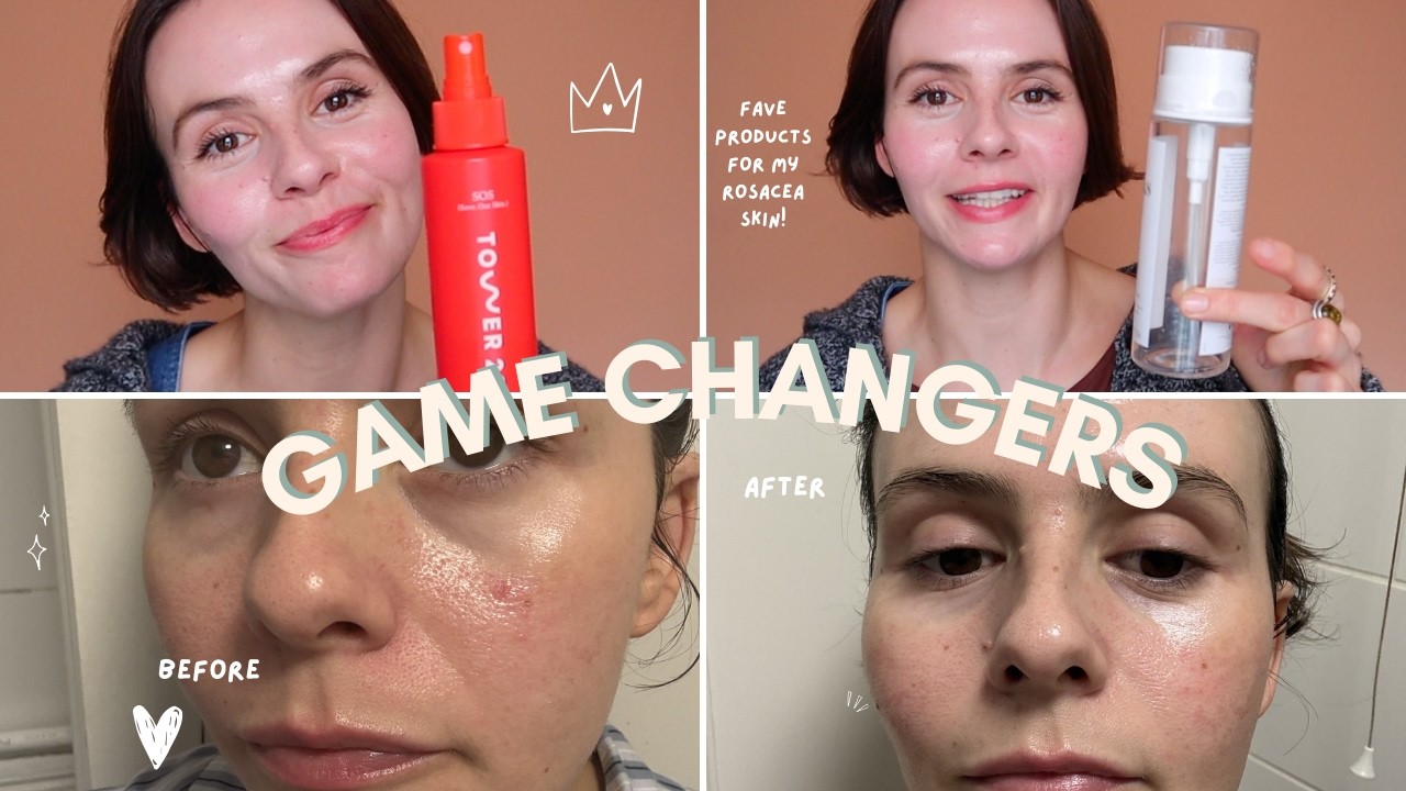 My Rosacea skin Game Changers