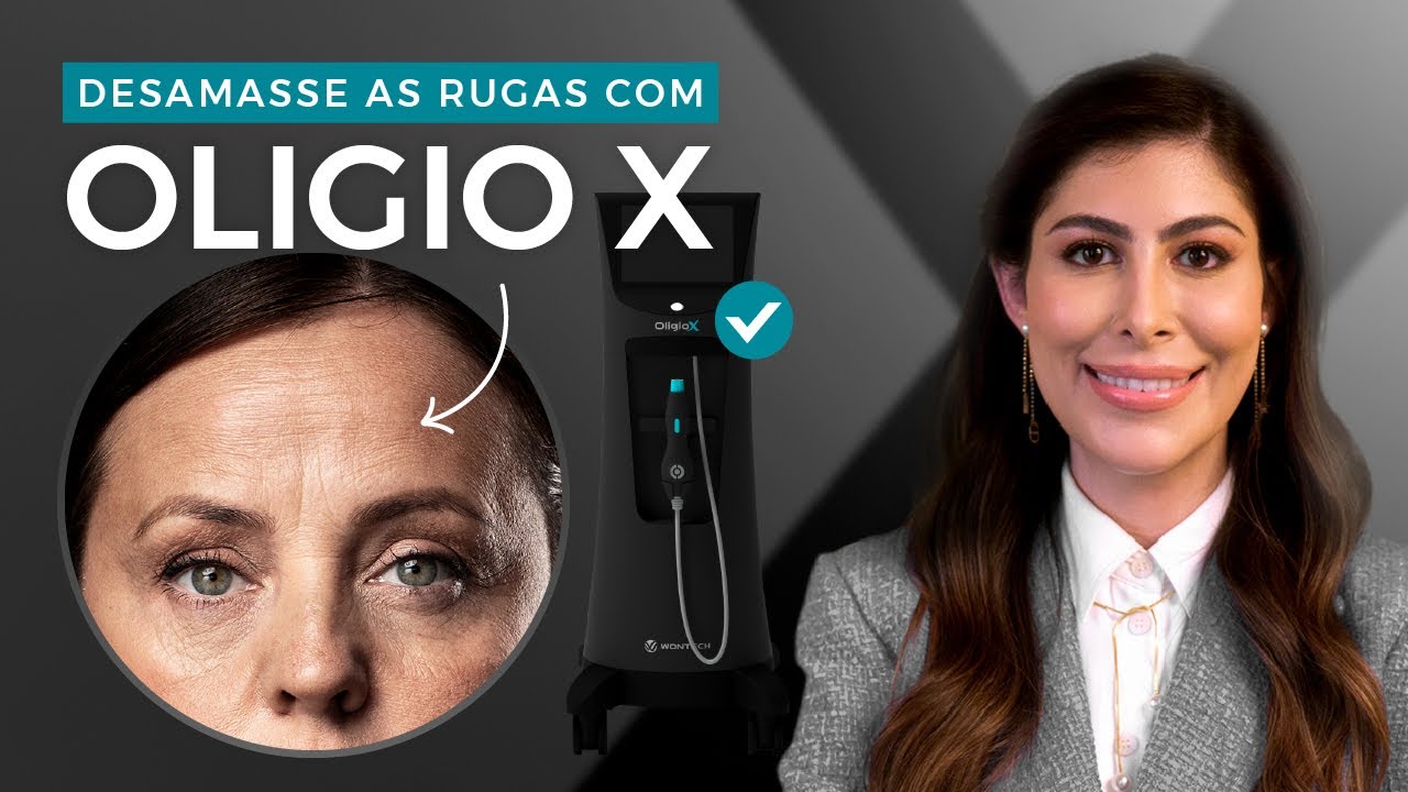 Oligio X: Como Desamassar Rugas com Radiofrequência Monopolar da Coréia | Dra. Daniela Aidar