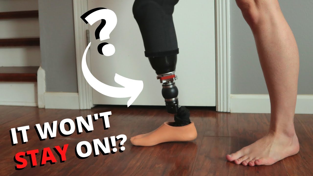 My Prosthetic Leg Won't STICK To Me?! (Socket Troubleshooting)