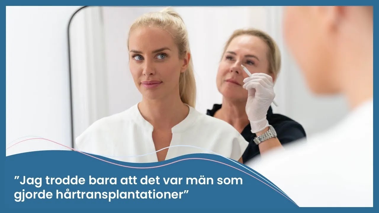 JULIA FRANZÉN valde att göra en HÅRTRANSPLANTATION