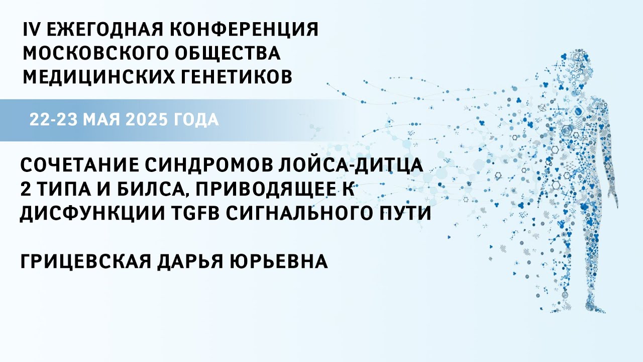 Сочетание синдромов Лойса-Дитца 2 типа и Билса, приводящее к дисфункции TGFb сигнального пути
