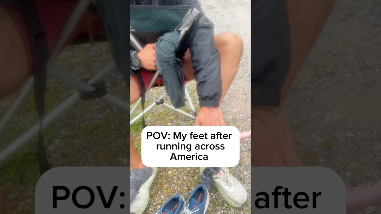 Which set of feet are worse? #running #hyrox #fitness #athlete #feet