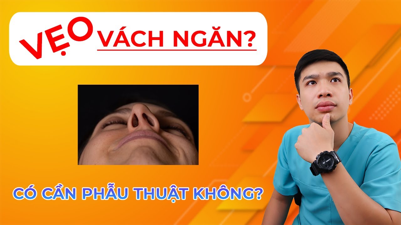 VẸO VÁCH NGĂN CÓ CẦN PHẪU THUẬT KHÔNG? - Anh Bác sĩ
