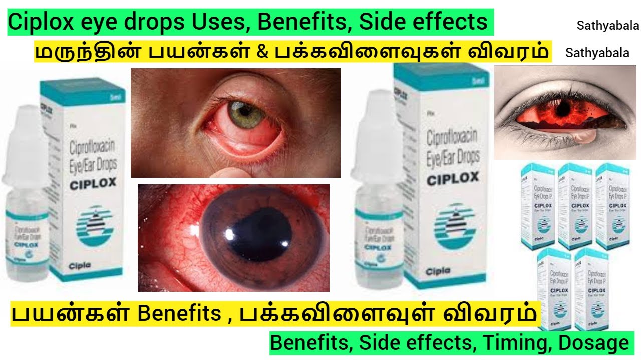 ciplox eye drops, ciplox eye ear drops, ciplox eye drops uses, ciplox eye drops in tamil, ciplox