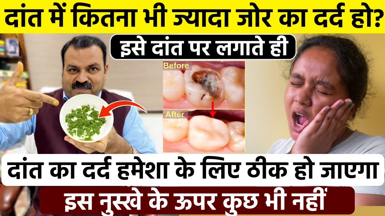 दांत में जोर का दर्द होगा तुरंत बंद, दांत में कीड़े, मसूड़ों से खून आना, सबसे का असरदार एक घरेलू इलाज
