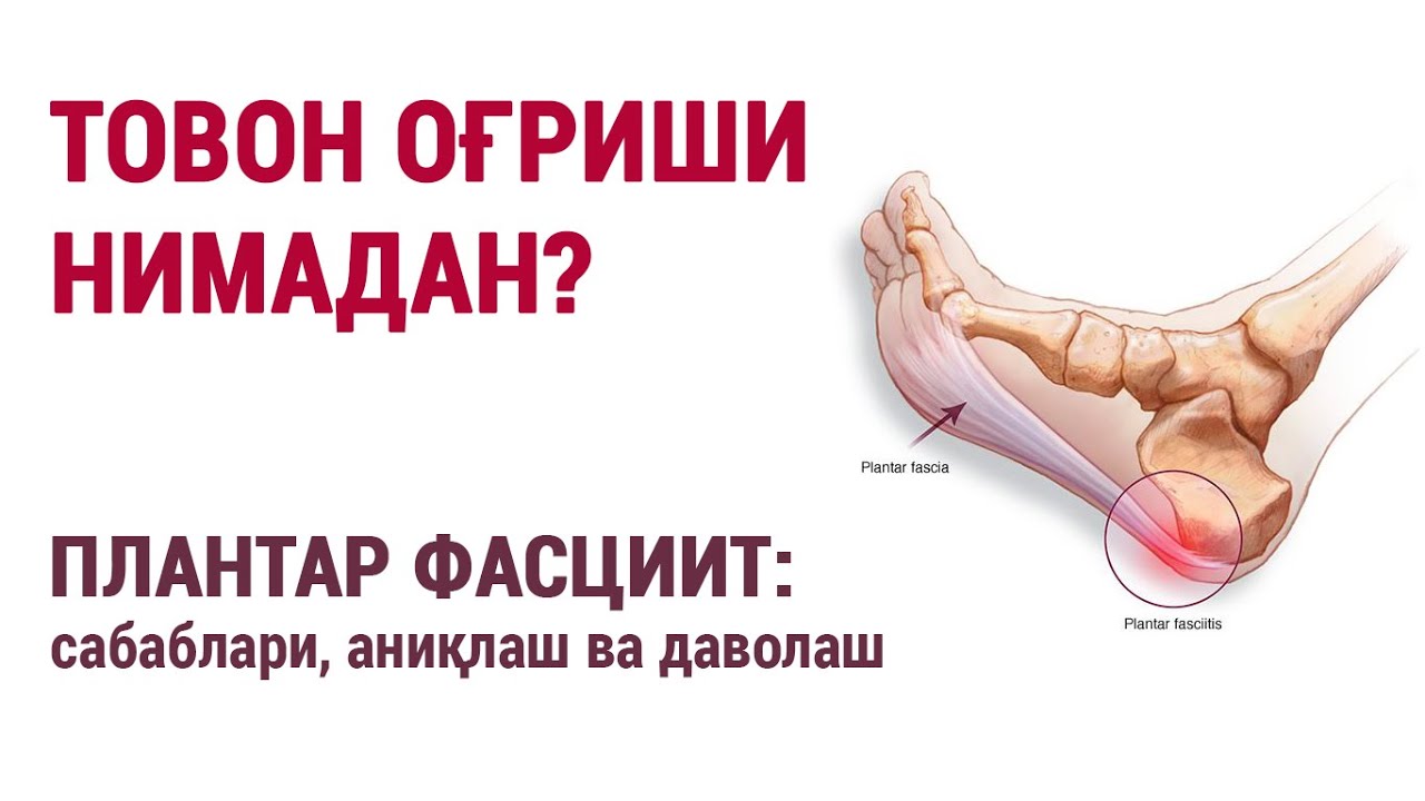 Товон оғриши нимадан? Плантар фасциит: сабаблари, аниқлаш ва даволаш.