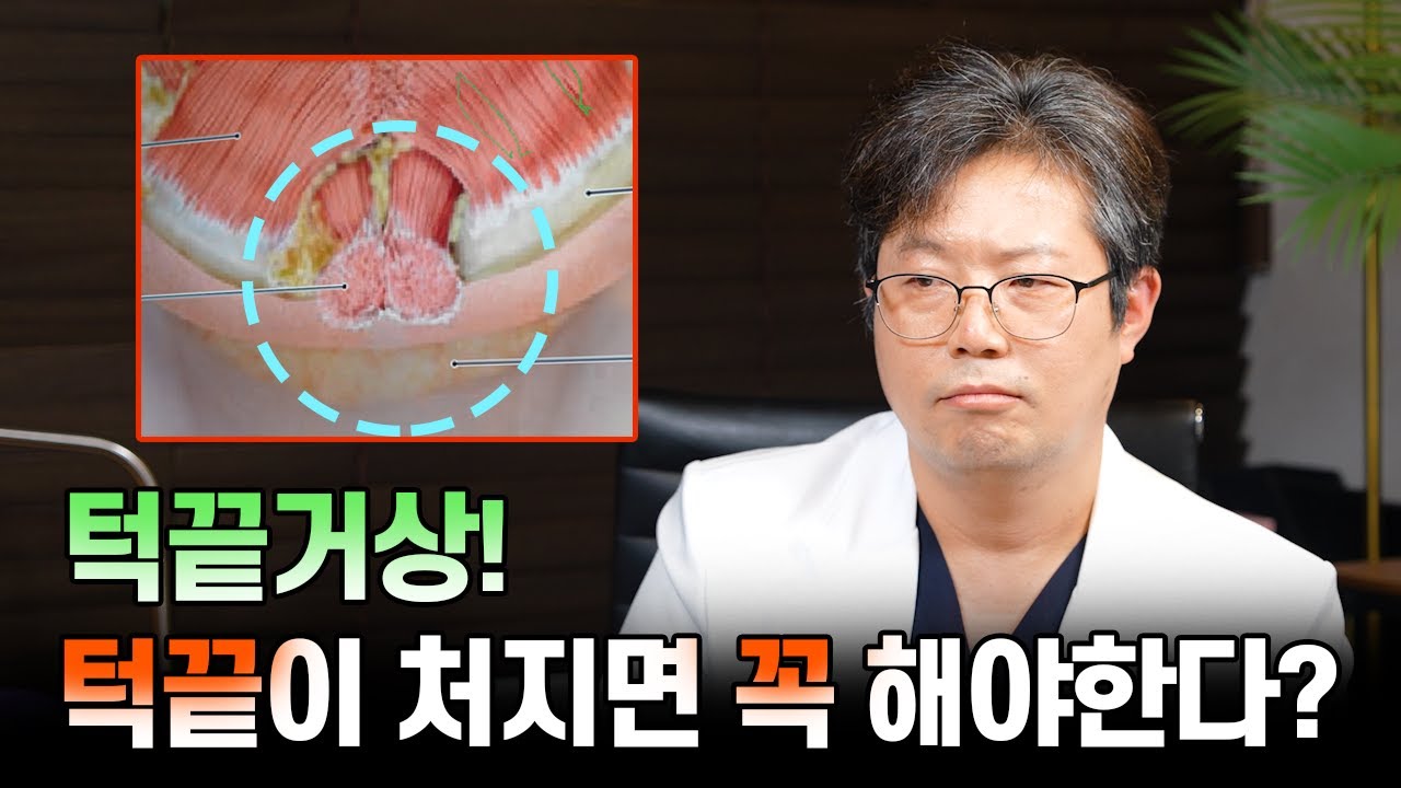 턱끝거상! 턱끝이 처지면 무조건 해야한다?