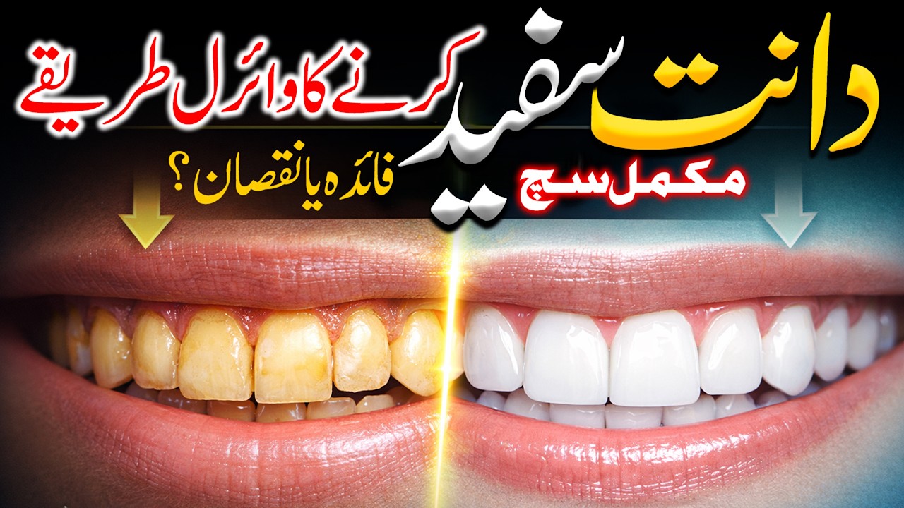 The Dangerous DIY Teeth Whitening Trends You Must Avoid in 2026 | Dr Aqeel Maqsood